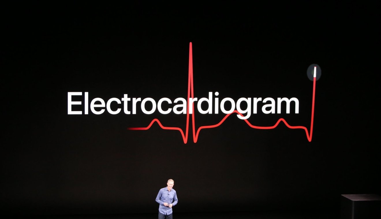 การตรวจวัด ECG บน Apple Watch Series 4 …สำคัญอย่างไร ?