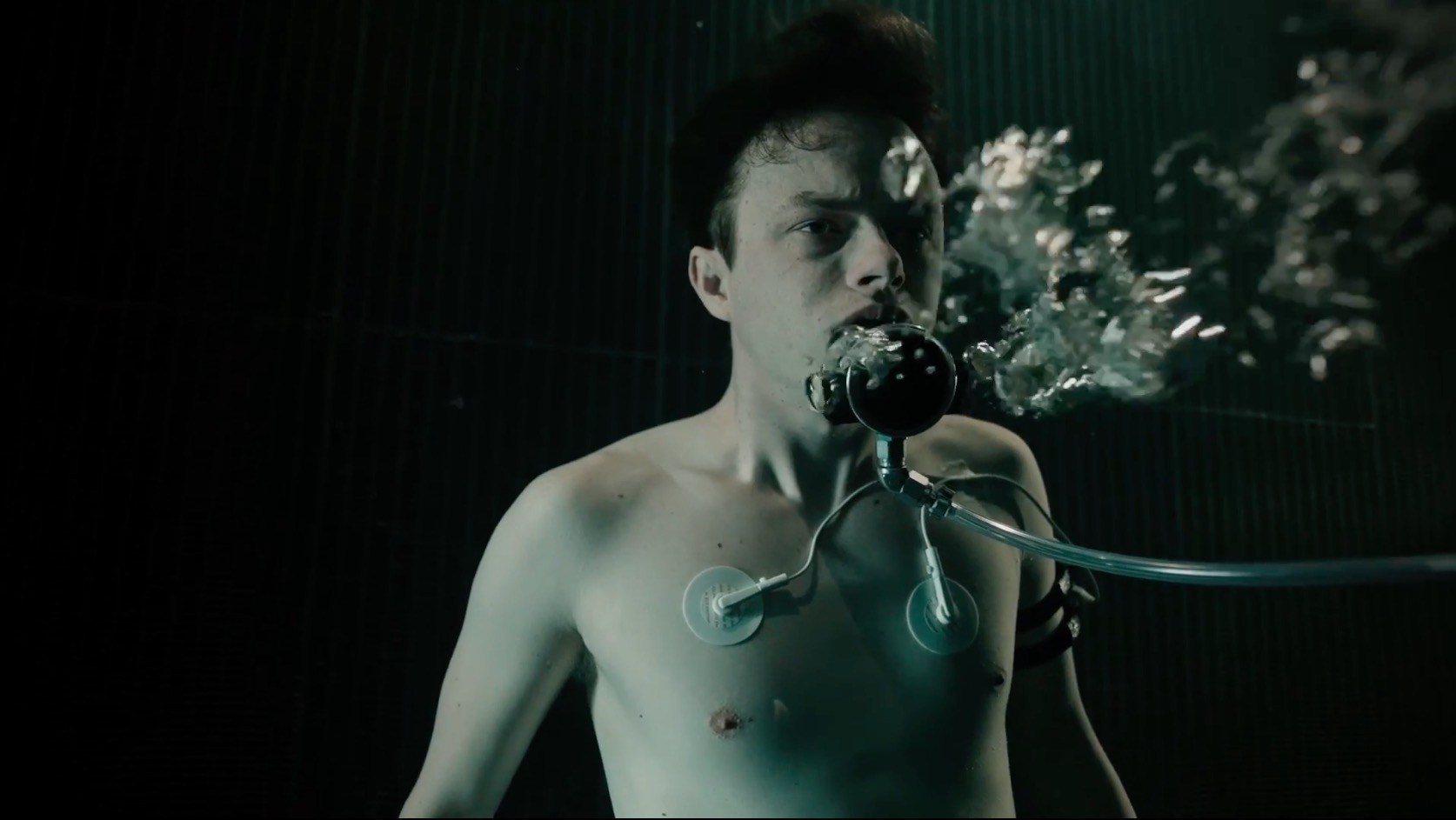 A Cure of Wellness (2016)