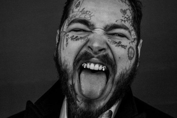 Post Malone ควักเงิน 50 ล้านบาท ทำฟันพร้อมฝังเพชรที่เขี้ยว